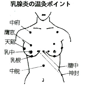 乳腺炎の温灸ポイント